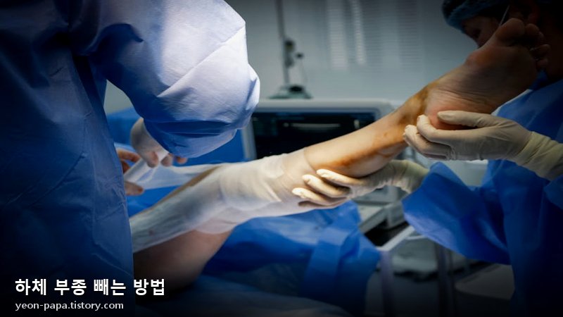 하체 부종 원인과 해결책 이미지