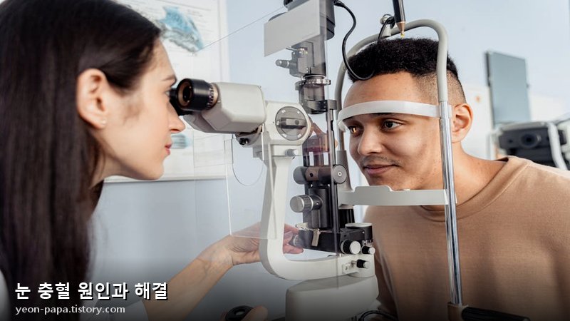 눈 충혈 원인과 해결