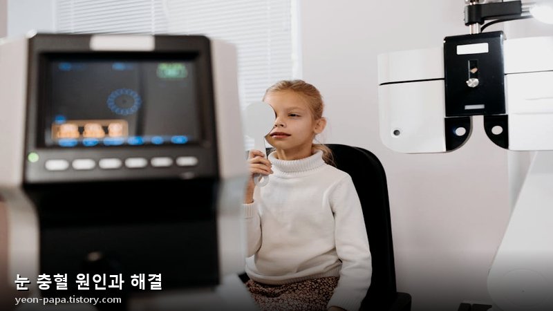 블로그 이미지