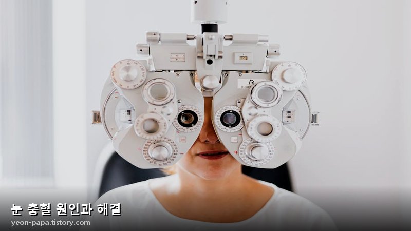 블로그 이미지