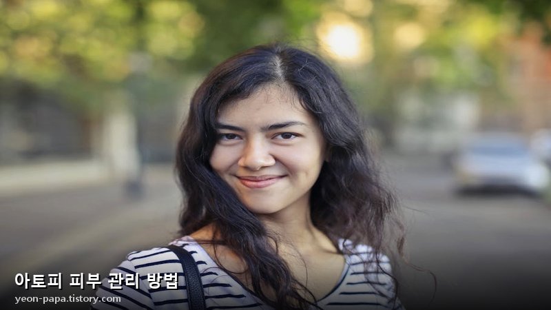 아토피 피부 관리 방법